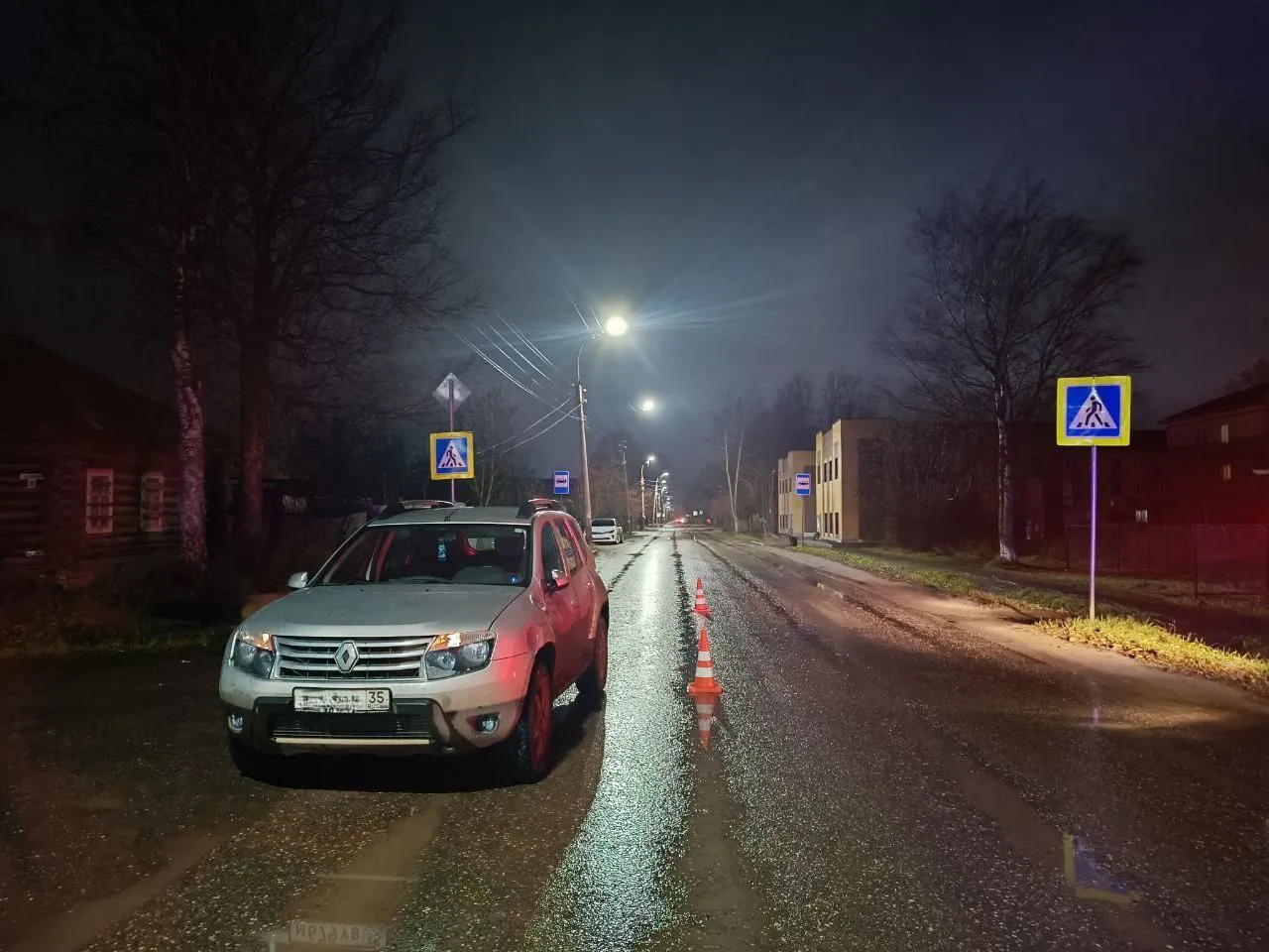 В Вологодской области пожилая женщина получила перелом при ДТП на пешеходном переходе