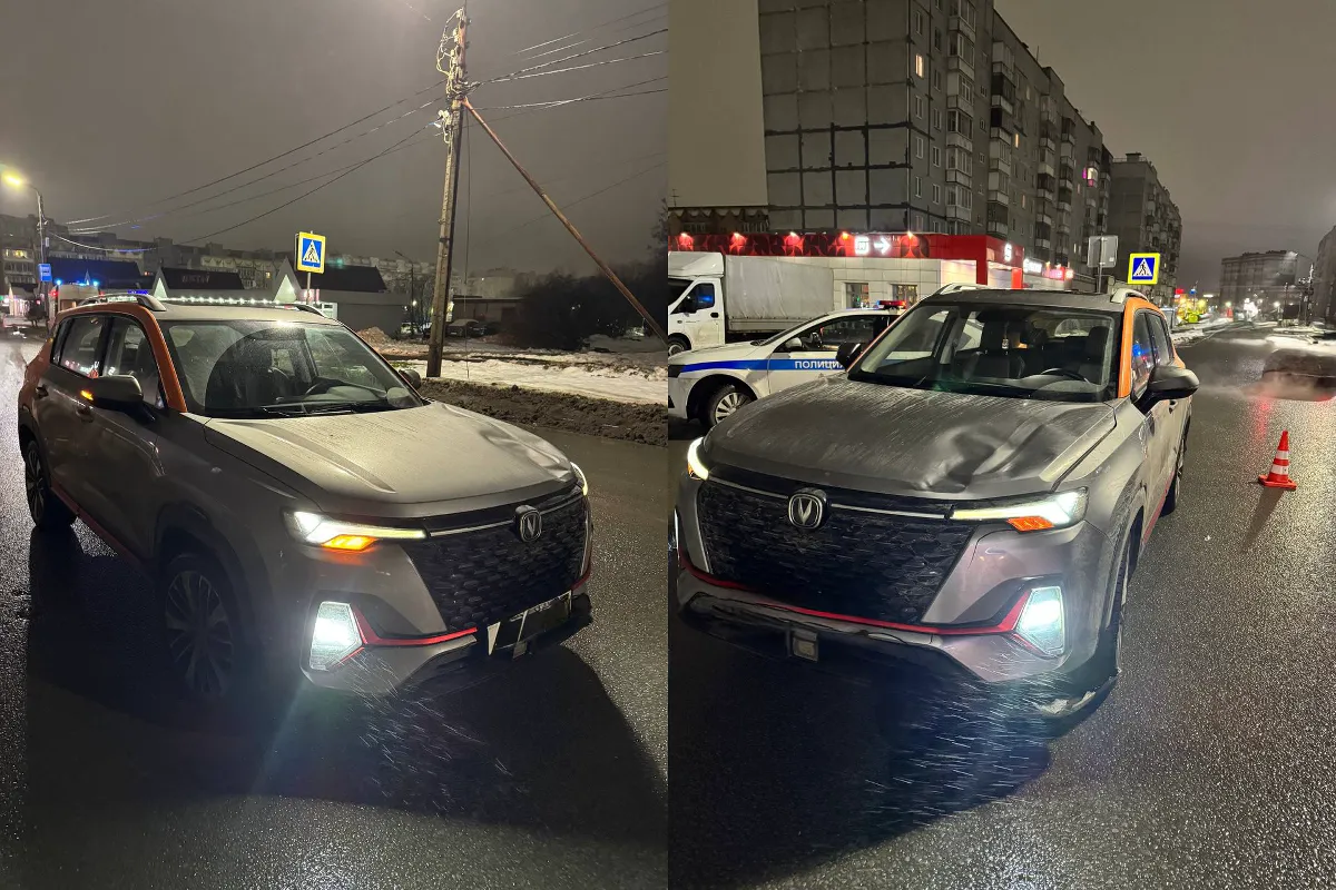 Пенсионерка попала под колёса автомобиля в Вологодской области и была экстренно госпитализирована