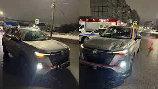 Пенсионерка попала под колёса автомобиля в Вологодской области и была экстренно госпитализирована