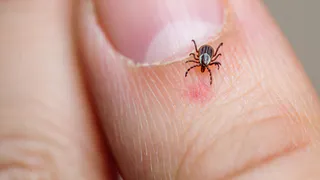 Клещи гибнут молниеносно: копеечное средство защищает лучше всех аэрозолей из магазина