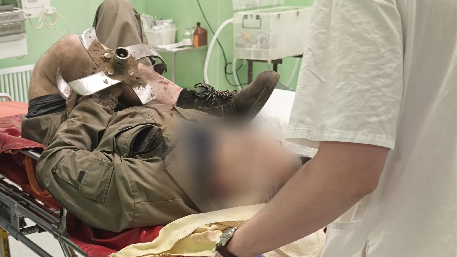 Перенес 10 операций и ушел на своих двоих: вологодские врачи спасли пенсионера с лопастью культиватора в ноге