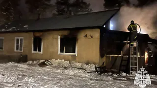 Житель Вологодской области пострадал при попытке потушить пожар в собственном доме