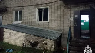 Мужчина устроил пожар в съемной квартире в Вологодской области и был госпитализирован
