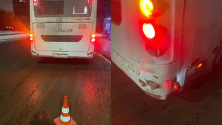 В Вологодской области школьнику выплатят 60 тысяч рублей за травмы, полученные при инциденте с автобусом