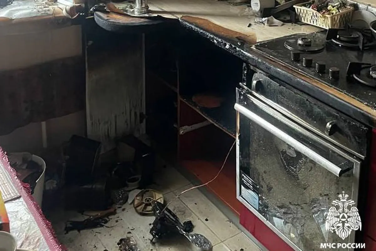 Пострадавшую на пожаре в Вологодской области женщину госпитализировали в больницу
