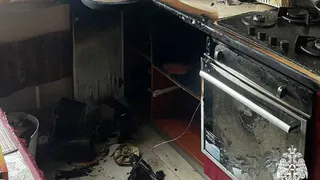 Пострадавшую на пожаре в Вологодской области женщину госпитализировали в больницу