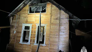 В Вологодской области при пожаре в дачном доме пострадала женщина